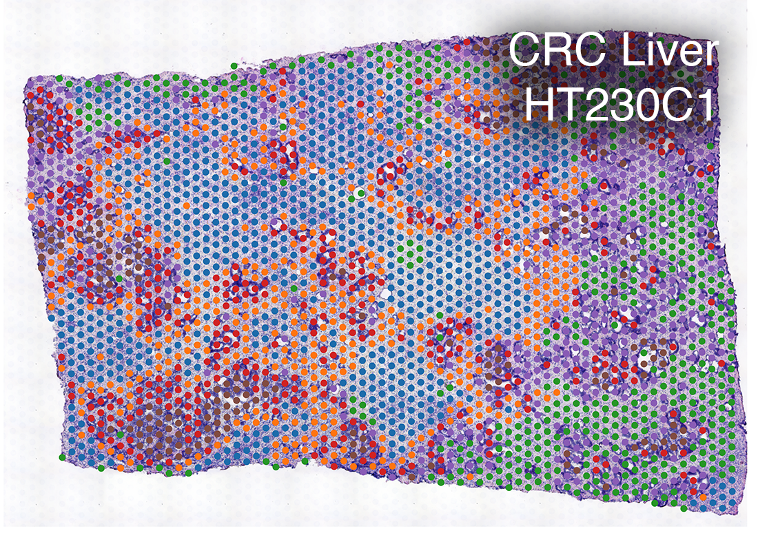 CRC_liver_HT230C1_plot_illust.png