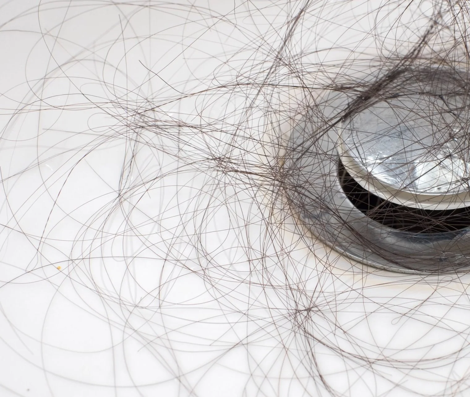 Alopecia Areata