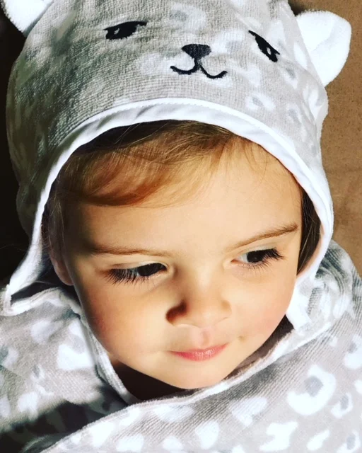 How To Comfort Your Child Through Their Eczema