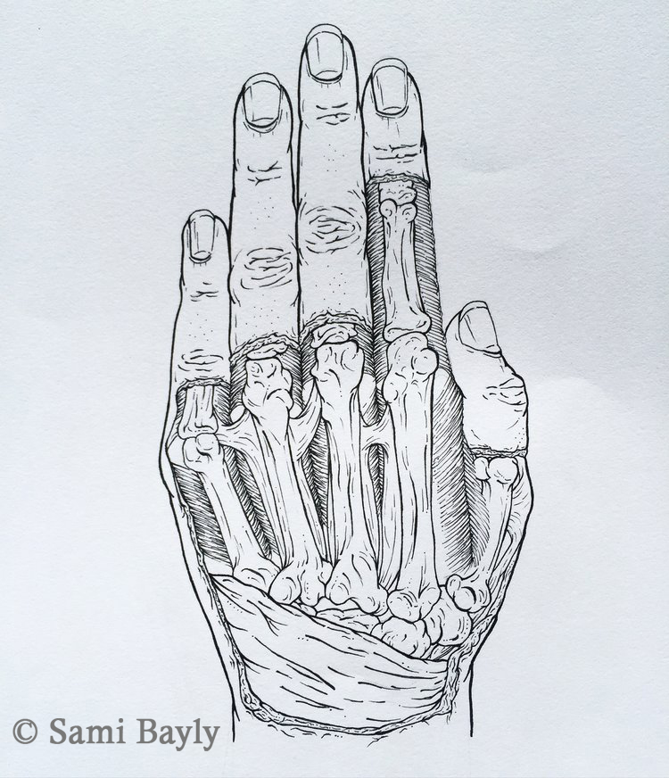X-ray Line Hand