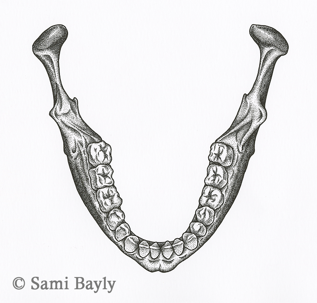 Jaw