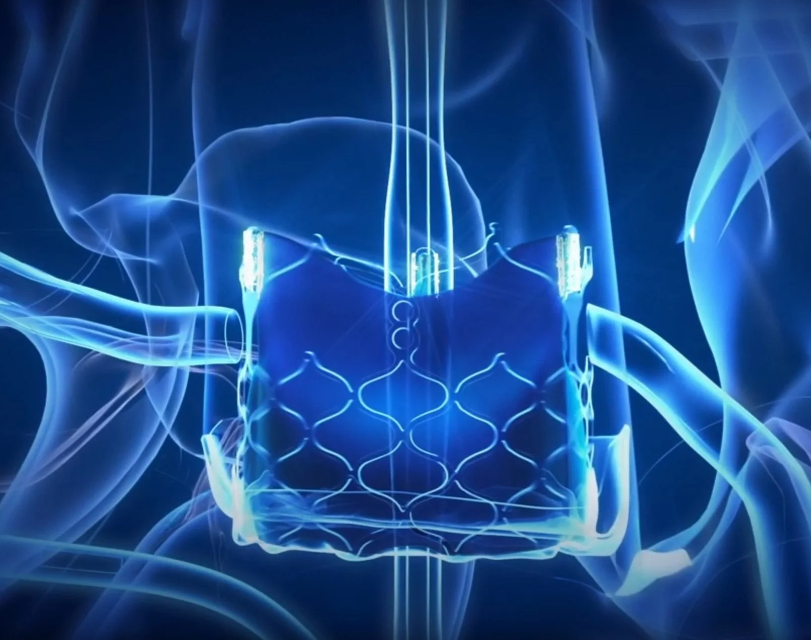 Anteris Technologies, Company Video