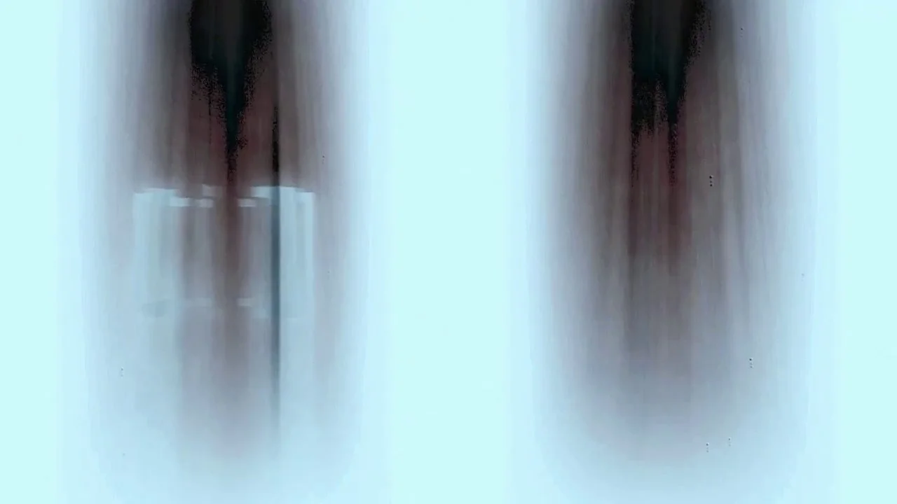Echo.jpg