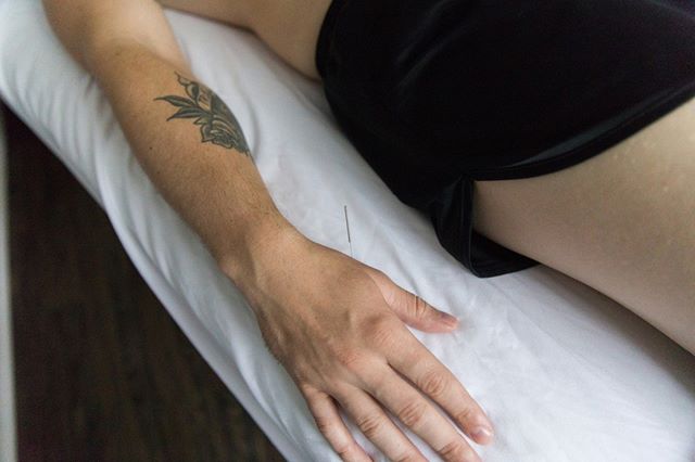 Acupuncture + Evidence ⠀⠀⠀⠀⠀⠀⠀⠀⠀
⠀⠀⠀⠀⠀⠀⠀⠀⠀
⠀⠀⠀⠀⠀⠀⠀⠀⠀
Hundreds of clinical studies on the benefits of acupuncture show that it successfully treats many conditions. At GCA, we specialize in treating pain of the neck, back, shoulders, ankles and wrists,