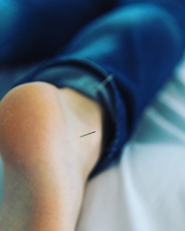 Acupuncture + Digital Detox
⠀⠀⠀⠀⠀⠀⠀⠀⠀
Need a digital detox? Put your foot down already! ⠀⠀⠀⠀⠀⠀⠀⠀⠀
* ironic that we are telling YOU, as we are posting this and as you read this on your device. Buuut we actually pre-schedule these posts so we can have 