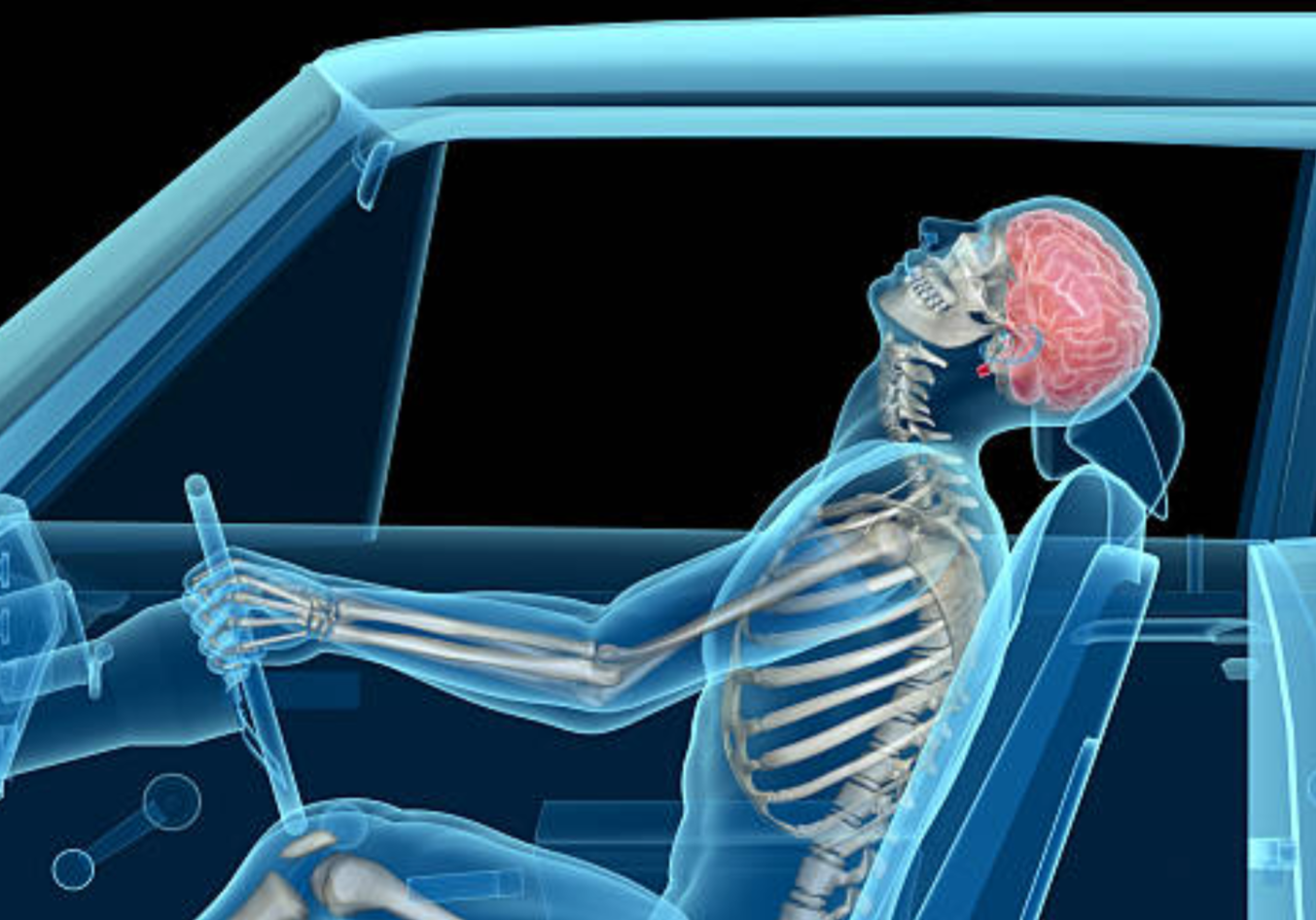Car Accidents