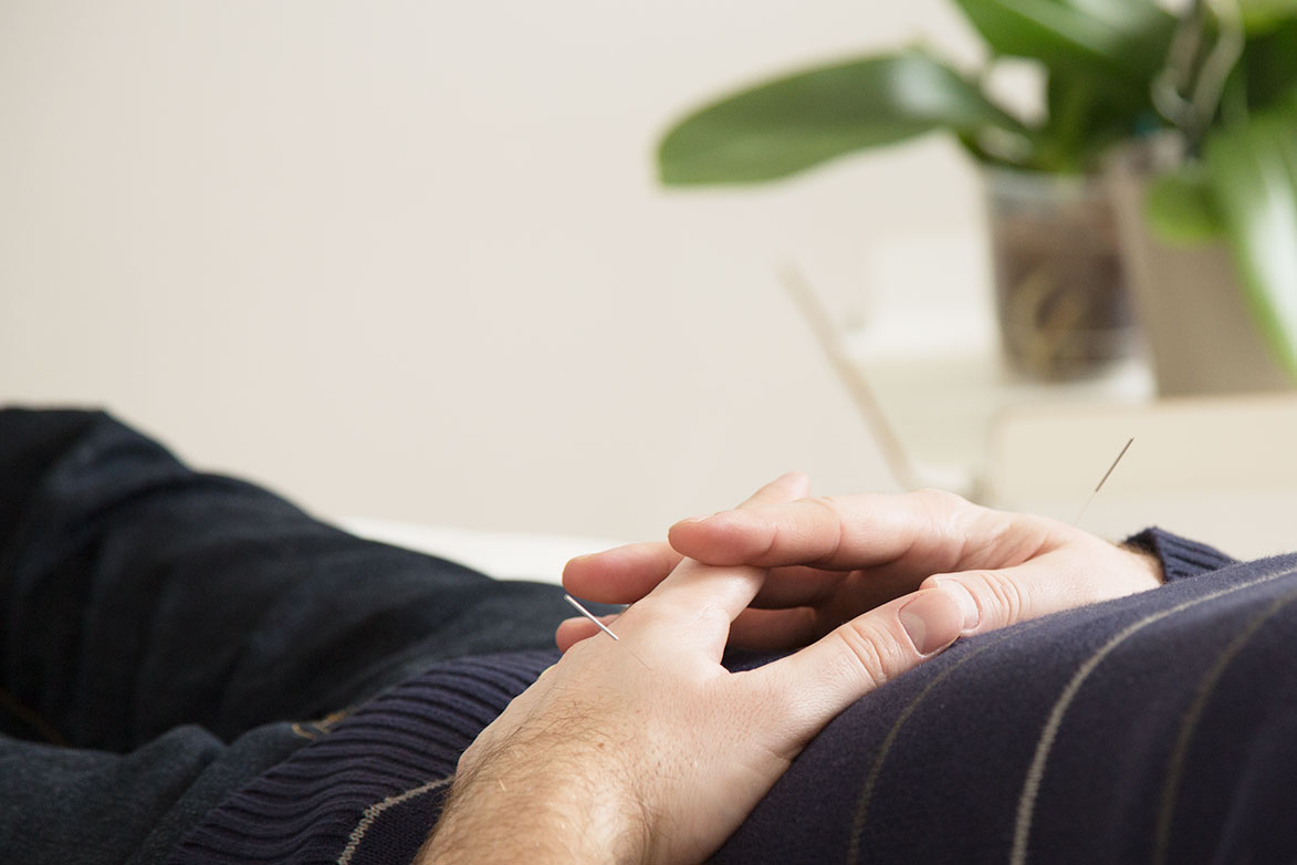 Samadhi Acupuncture and Holictic Medicine — Acupuncture
