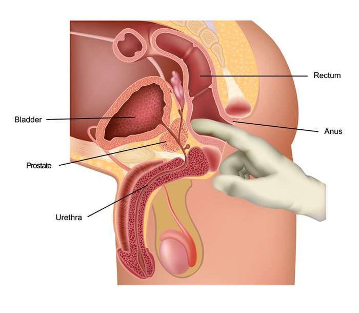 Prostate-Massage.jpg