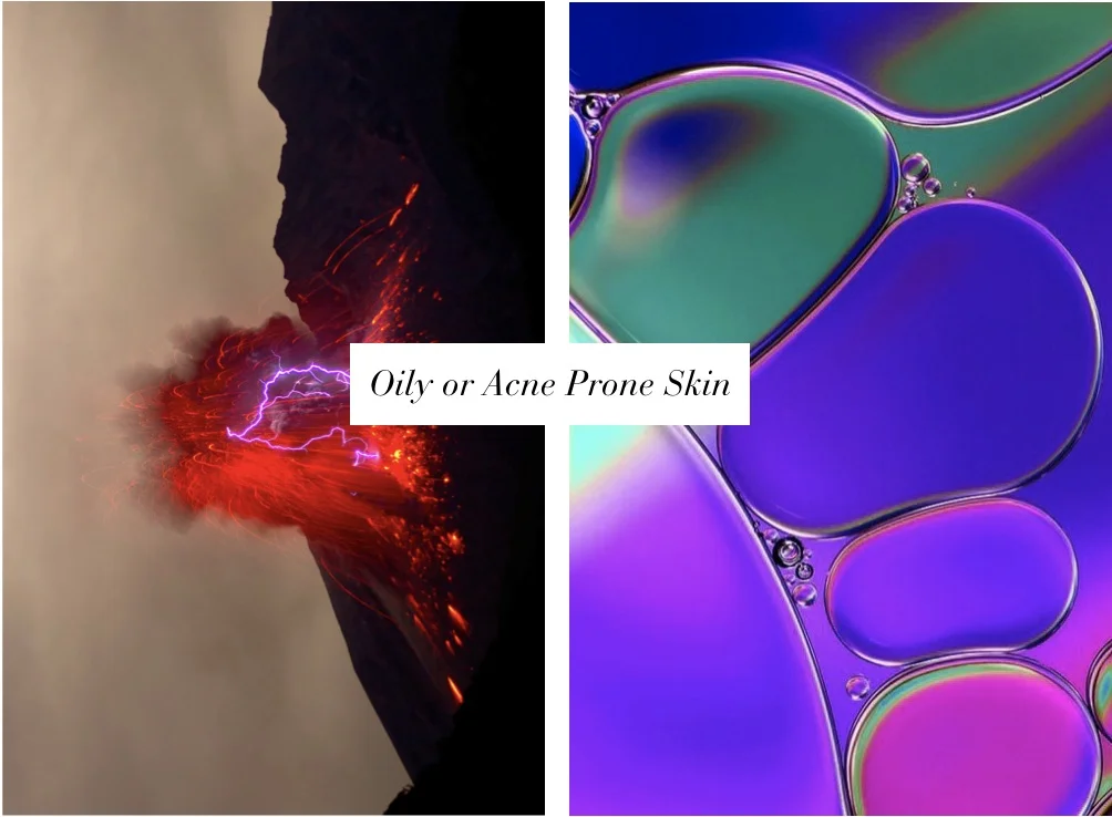 face-oils-acne-prone-key-kudisco.jpg