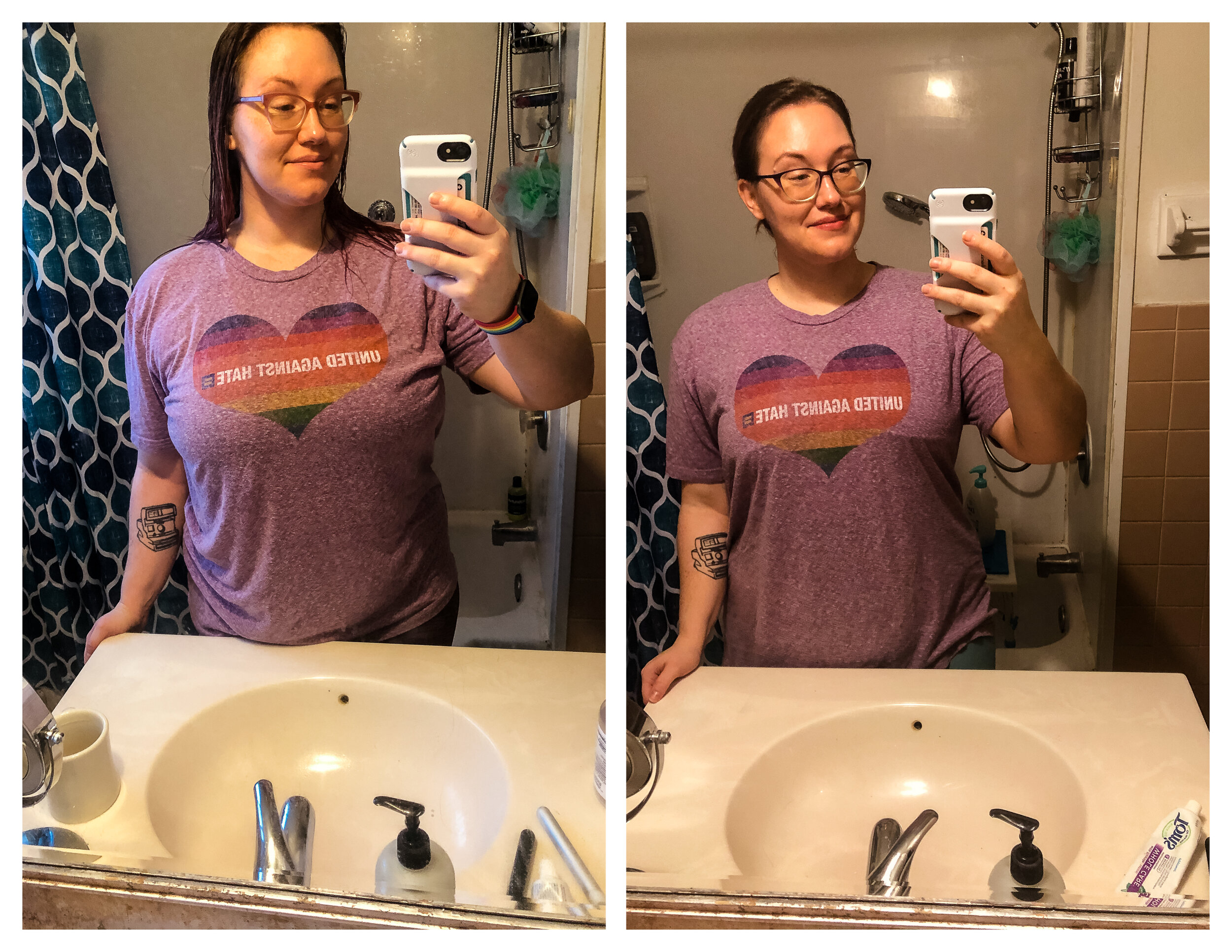 My Breast Reduction Story: Before, During, and After — DUTCHER PHOTOGRAPHY
