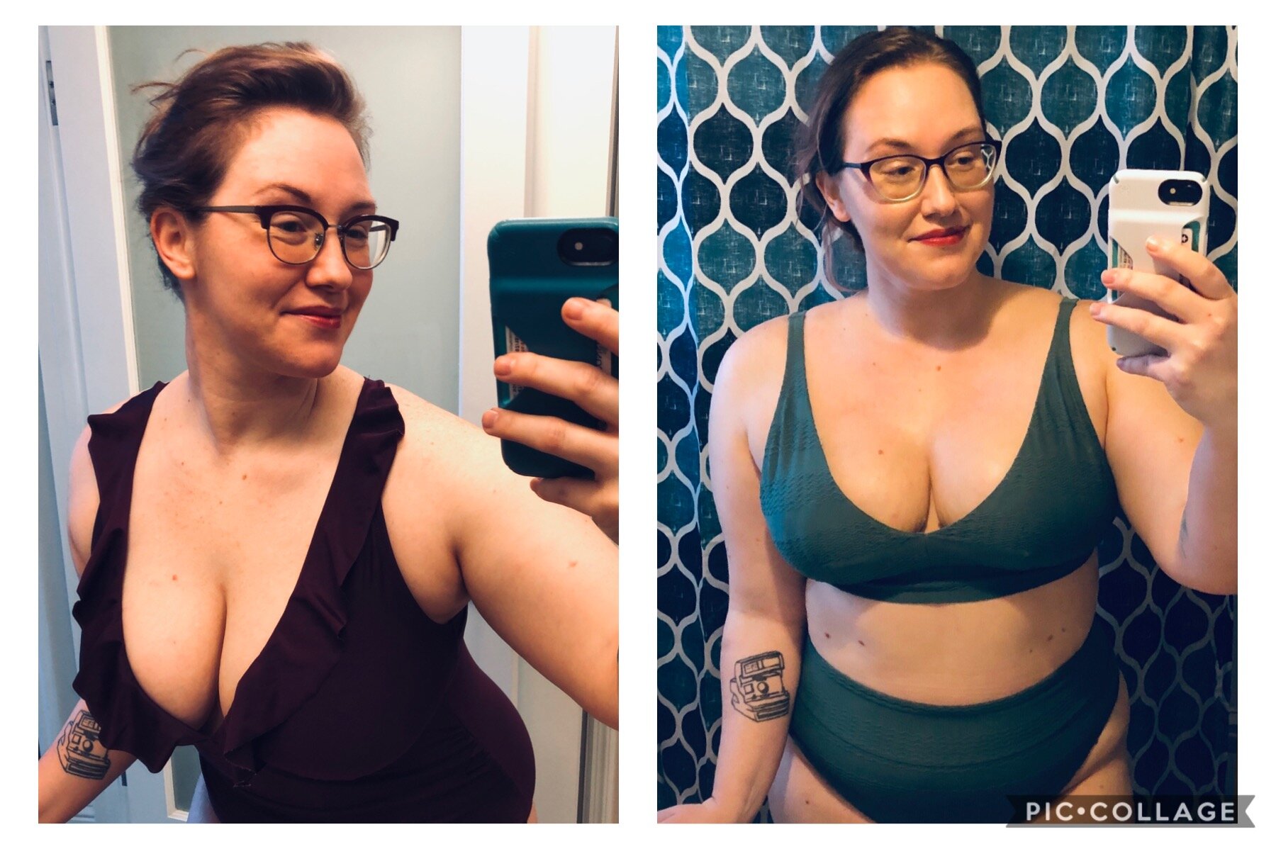 Before and after breast reduction! I feel amazing. : r/bigboobproblems