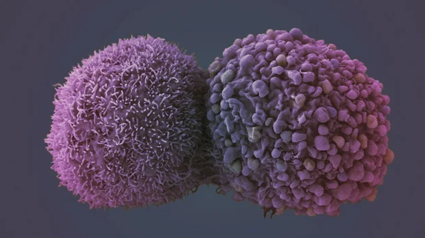 How Liquid Biopsies Aid in the Treatment of Lung Cancer