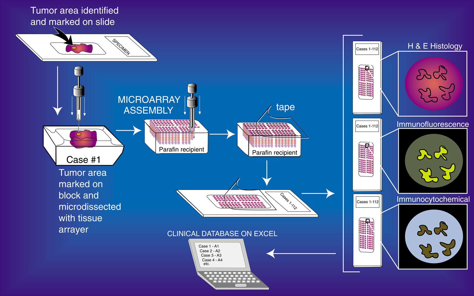 Tissue_Microarray_Process.jpg