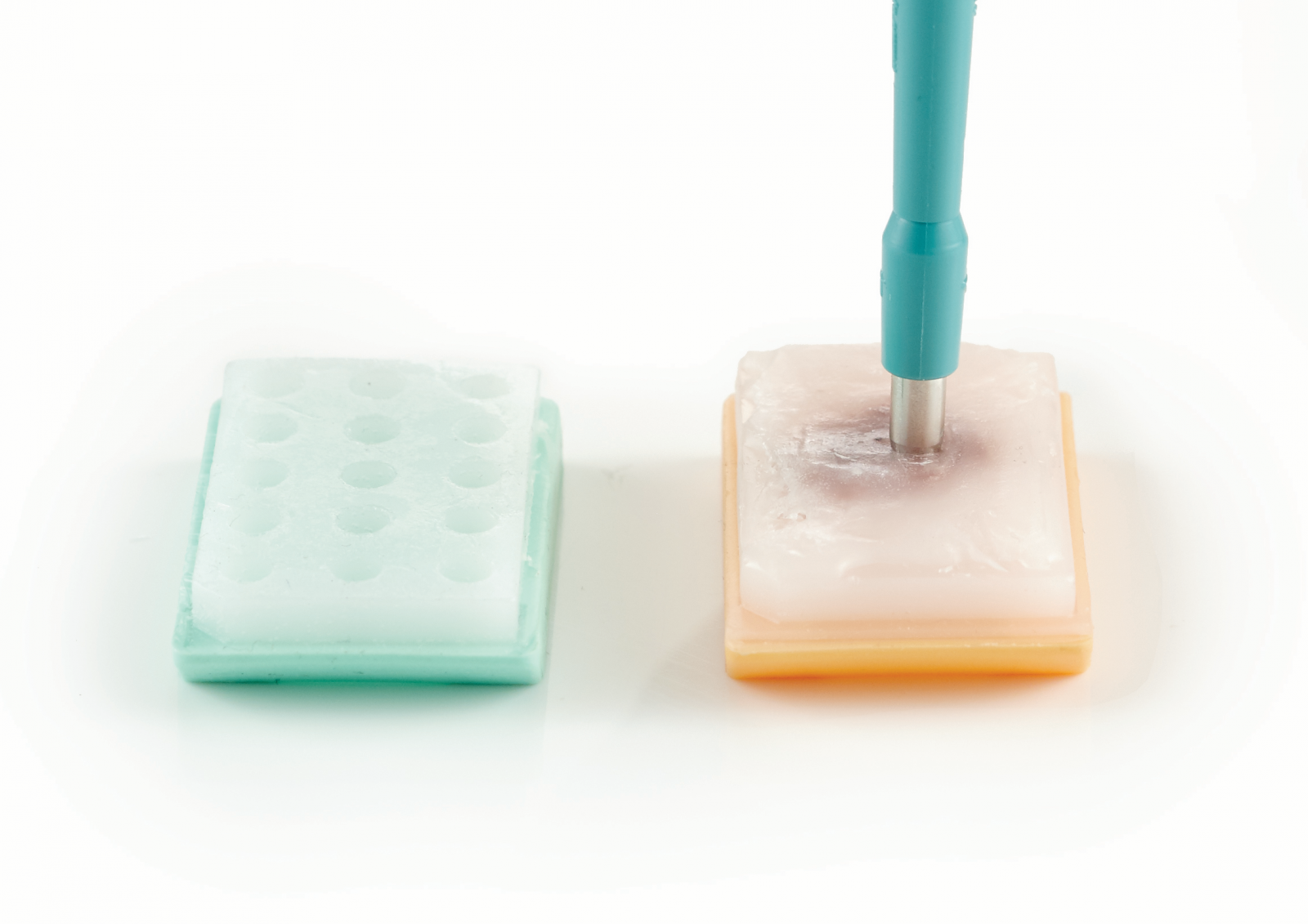 Tissue Microarray: An Evolving Diagnostic and Research Tool