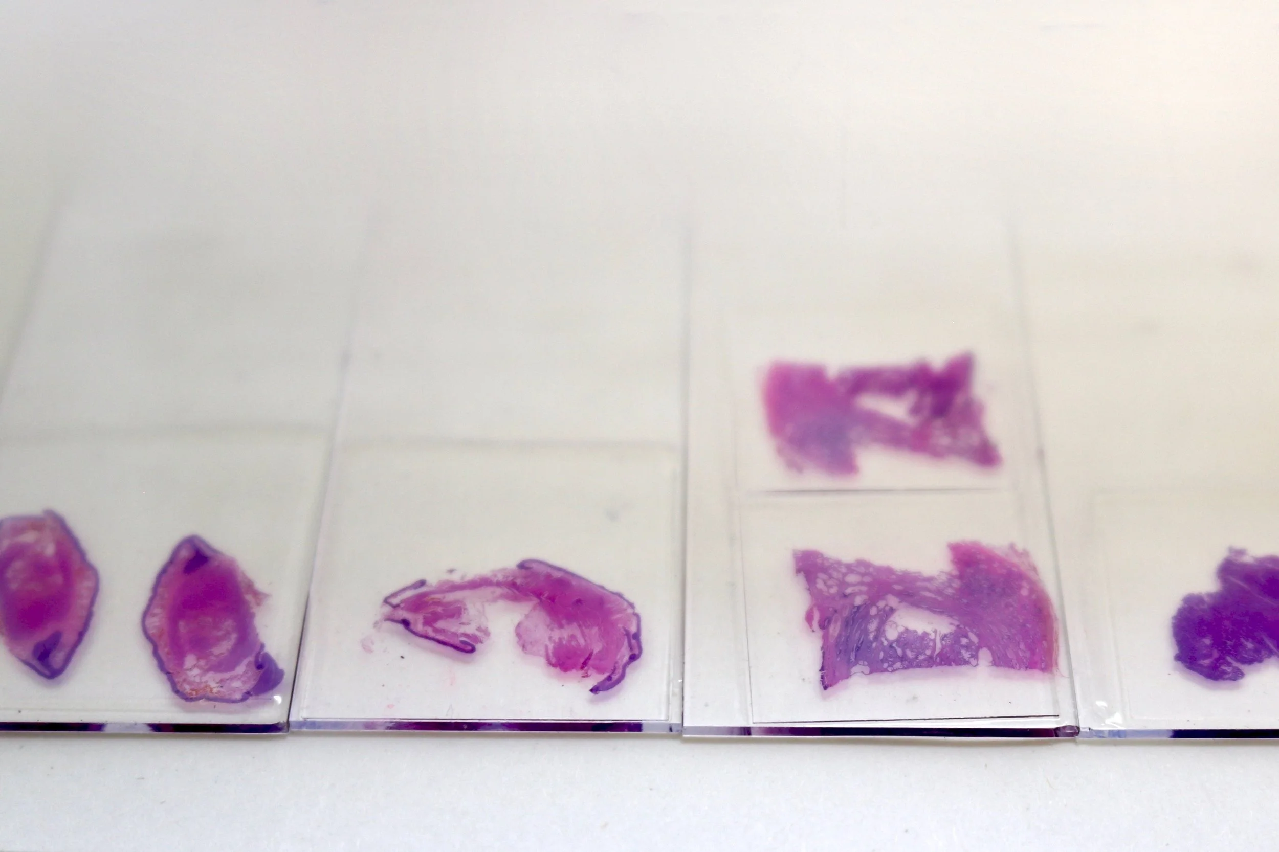 Tissue Microarray