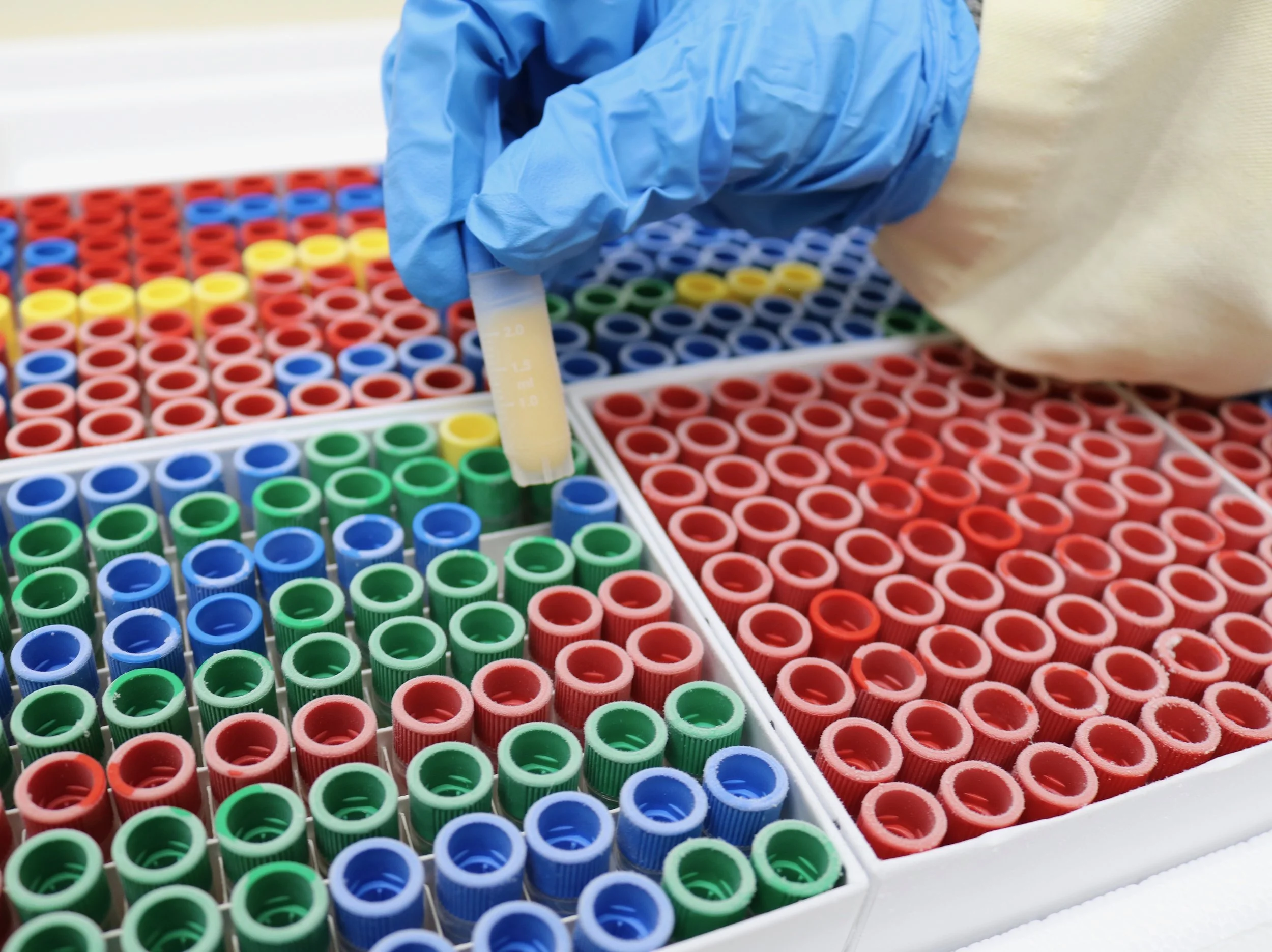 What are FFPE Samples