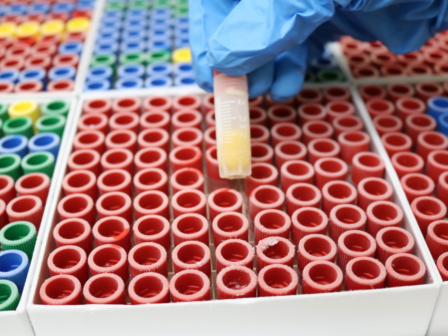 Human Blood Samples in Biobanks