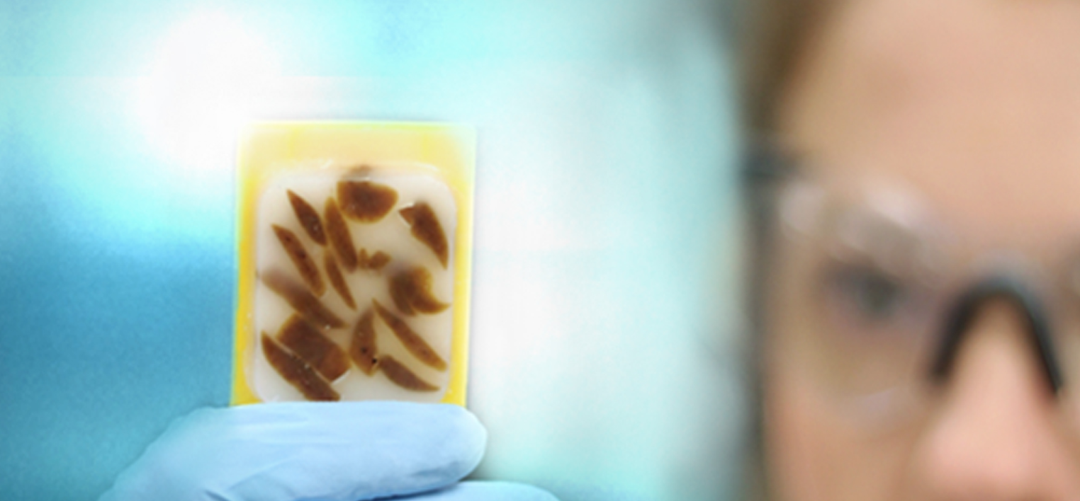 Different FFPE Methods and Their Impact in Medicine