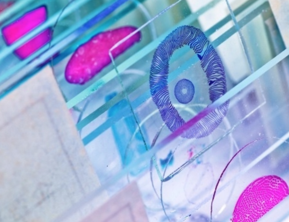 FFPE vs Tissue Microarray's