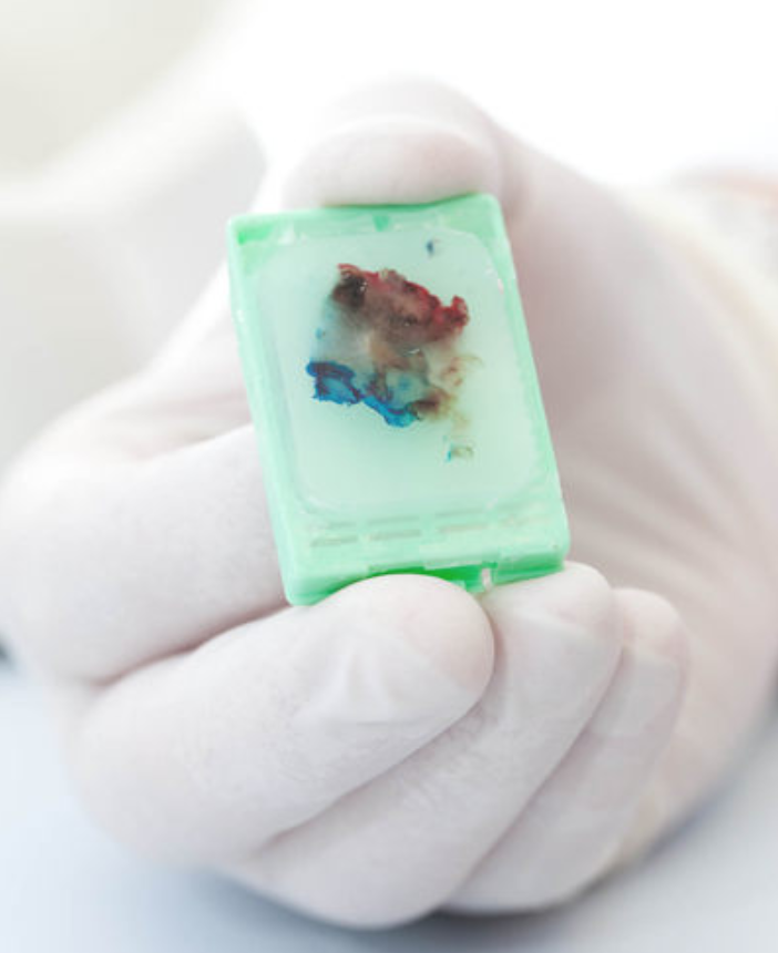 Paraffin Embedded Tissue: What is it?