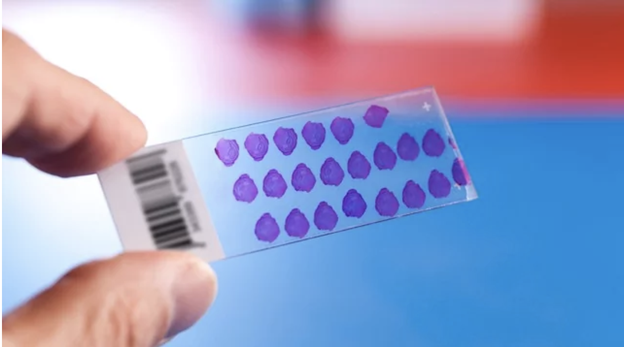 Tissue Microarray’s Use in Biobanks