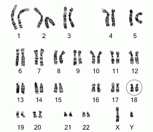 How to Diagnose Chromosome Abnormalities 