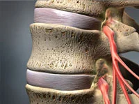 Neck Conditions →