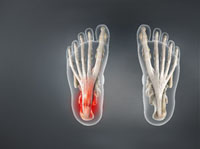 Foot & Ankle Conditions →