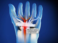 Hand & Wrist Conditions →
