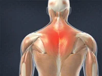 Sports Injuries →