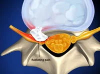 → KNEE PAIN