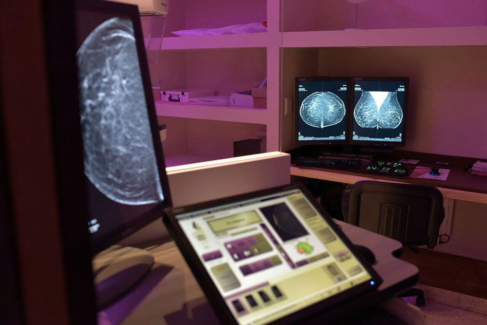 dmi-mamografia-digital-directa.jpg