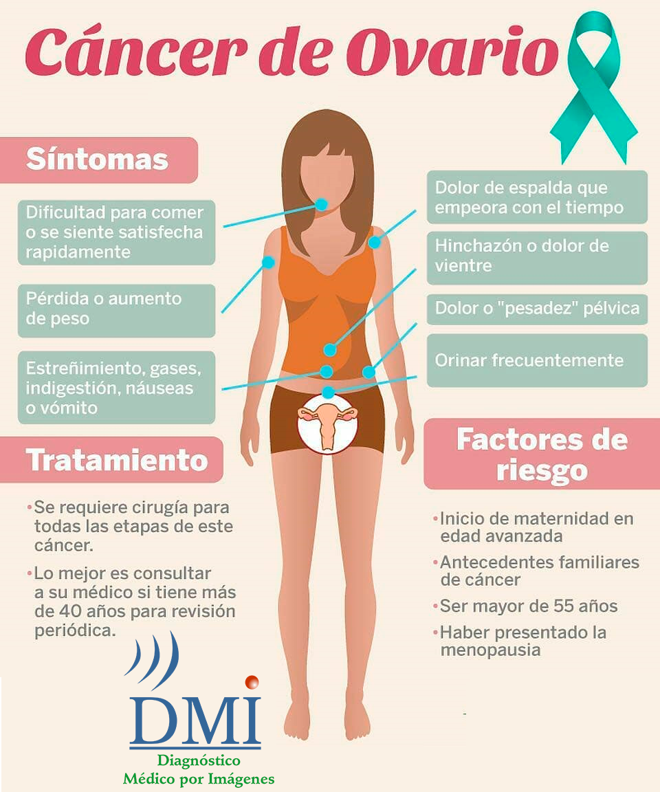 Día Mundial del Cáncer de Ovario — DMI - Diagnóstico Médico por Imágenes