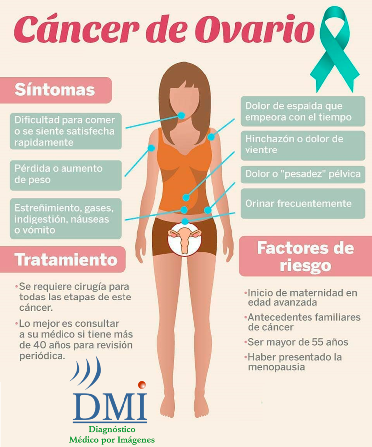 cancer-ovariodmi.png