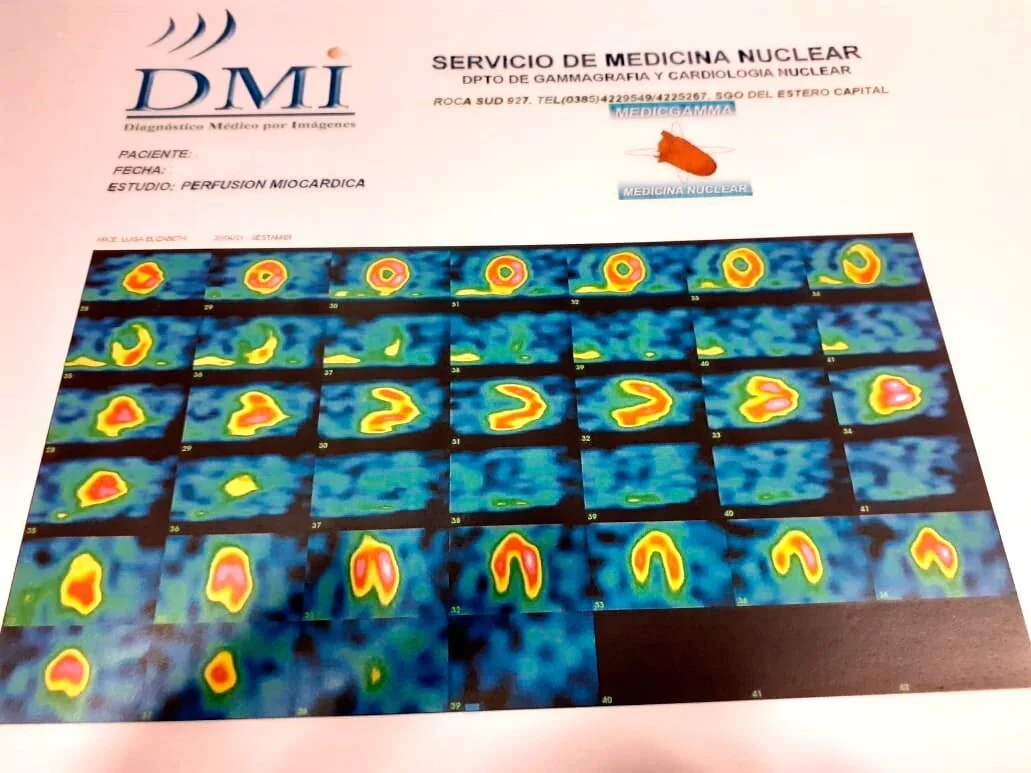 Medicina Nuclear - Cámara Gamma: estudios funcionales para diagnósticos más precisos