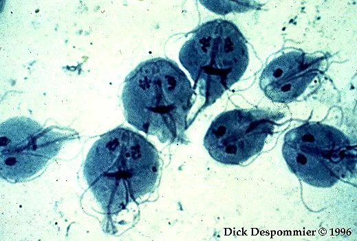 Ayurvedic Approaches to Intestinal Parasites