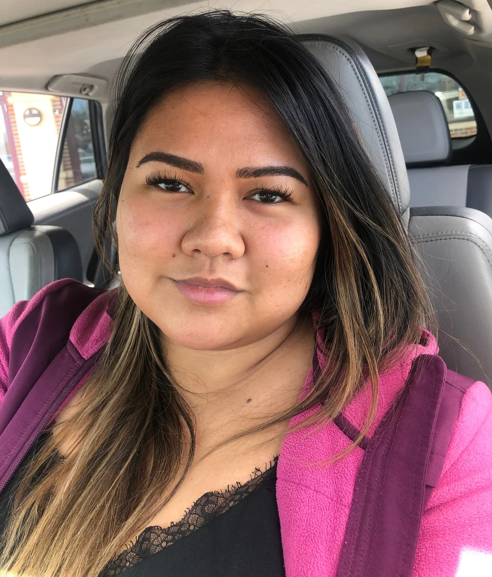  Day 5. As you can see in this photo, the skin at the front of my brows started to flake and lift.  