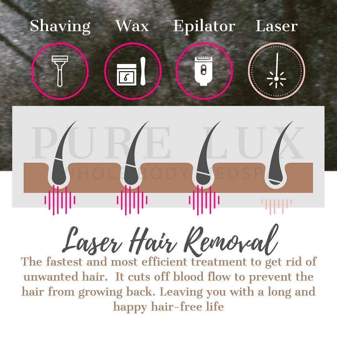 How can laser hair removal be permanent? ⁠⠀
⁠⠀
It cuts off blood flow to prevent the hair from growing back.  However, it's important to know that not all lasers are created equally.  The energy that is delivered into the hair follicle can vary from 