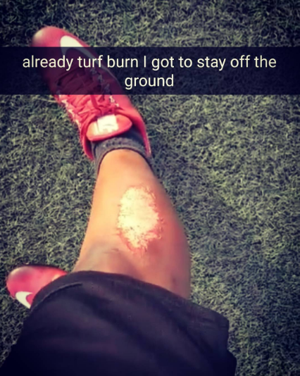  #TurfBurn 's are #TheWorst then I twist my #ankle multiple times today too!!! Smh #CantWinForLosing but I'm striving to #BeBetter#BiggerFasterStronger #MentalAthleticism#YaaEfitness 