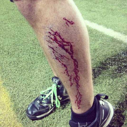  @greg_rice goes hard #ultimate#turfburn #goodbid #didntcatchit 