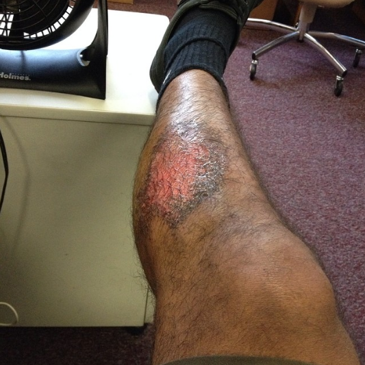  What I do for my team 😝&nbsp;#TKFC #turfburn #leaveitallonthepitch#futbol #soccer 