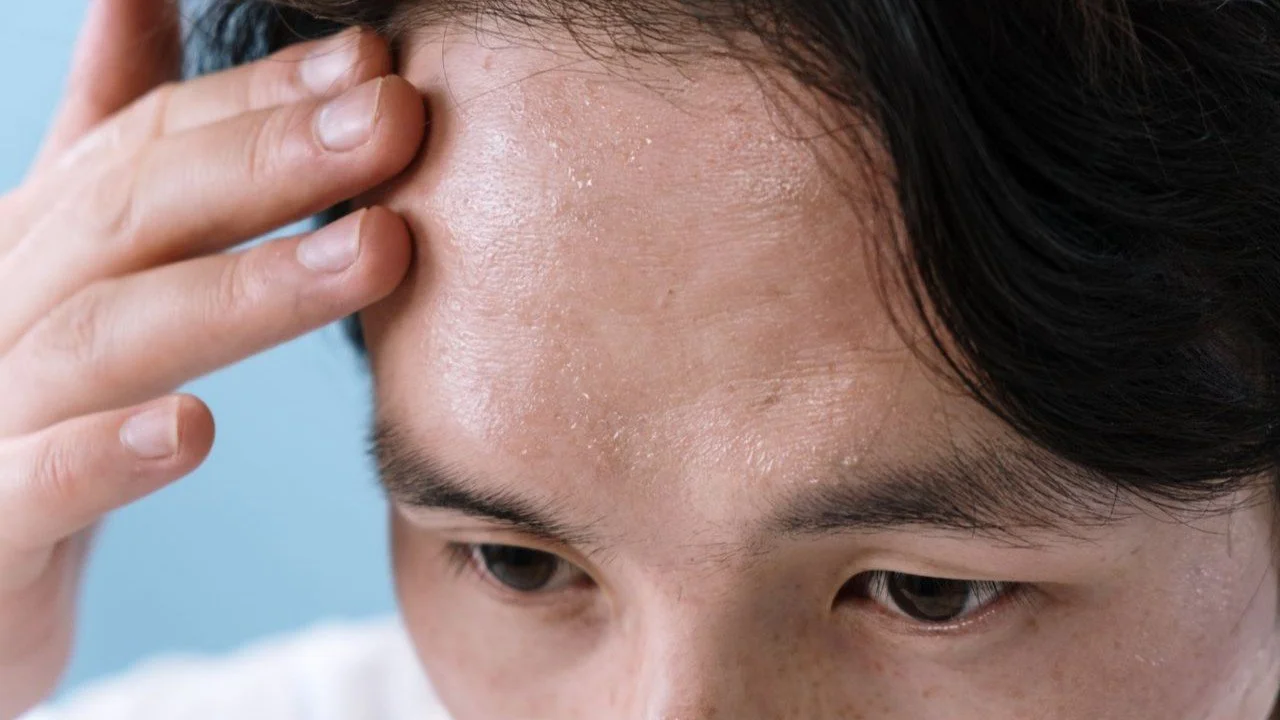 Wajah Kering dan Kasar karena Kebiasaan Cuci Muka