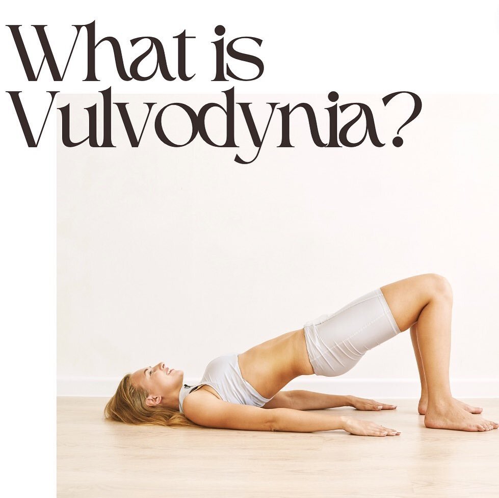 Vulvodynia is a chronic pain condition that affects the vulva, which is the external female genital area, including the labia, clitoris, and vaginal opening. Women with vulvodynia experience persistent, unexplained pain or discomfort in the vulvar re