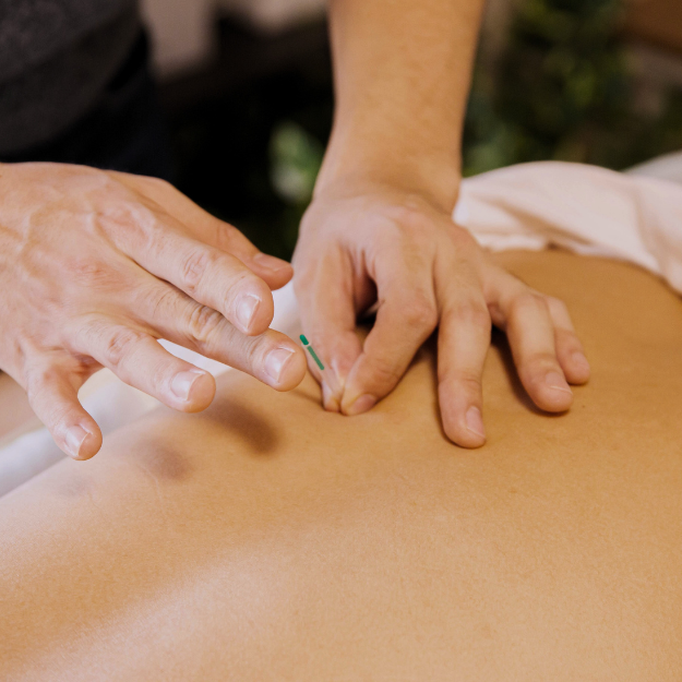 Acupuncture in Pregnancy and Labour Preparation: A Central Coast Birth Educator's Perspective.