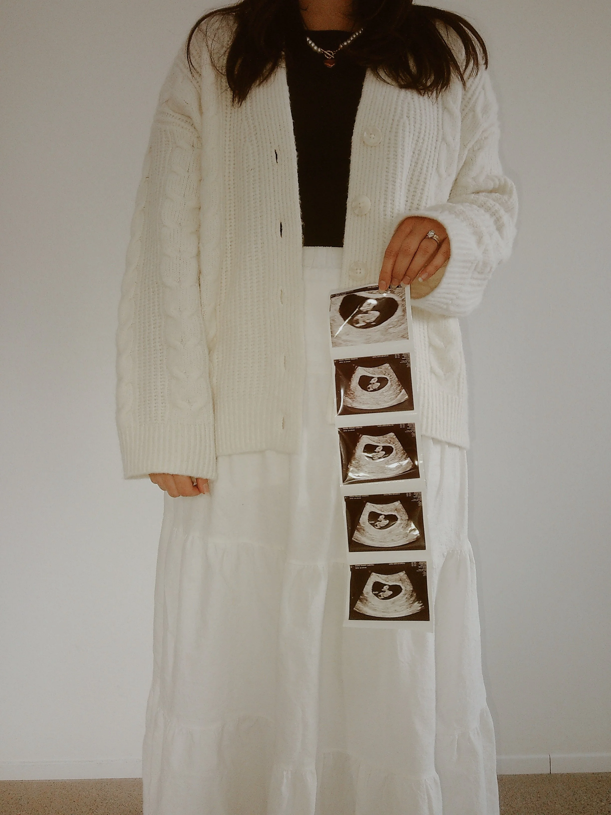 Hospital Antenatal Classes vs Independent Birth Classes | Central Coast Guide