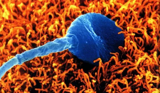 hay mucha posibilidad de quedar embarazada con el liquido preseminal