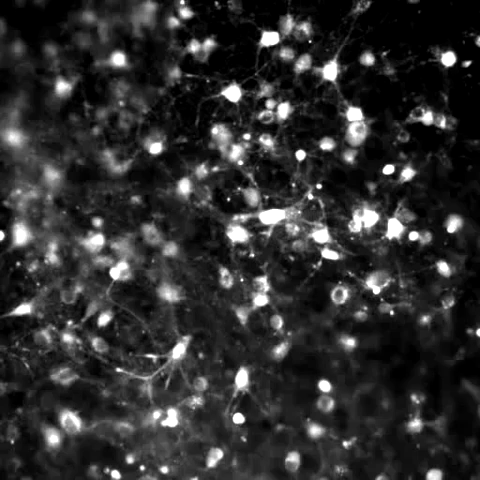 Live Neuronal Activity - courtesy of Michelle Kuykendal & Gareth Guvanasen