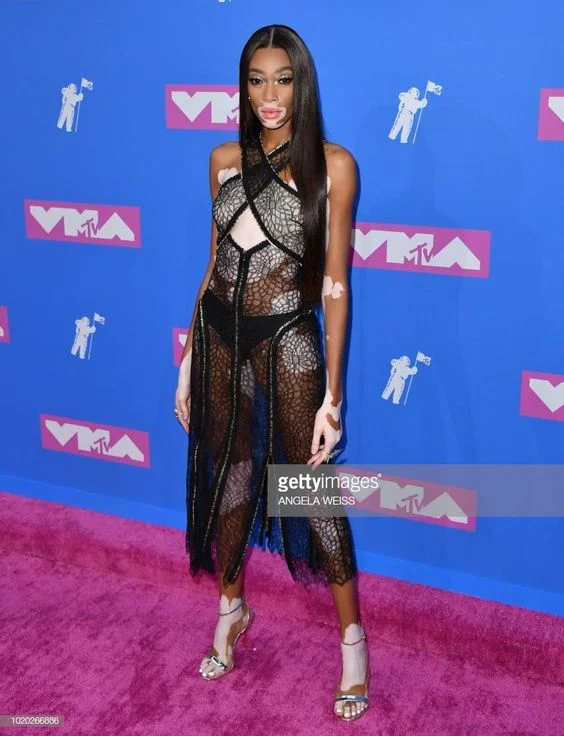 Winnie Harlow at the 2018 VMA's