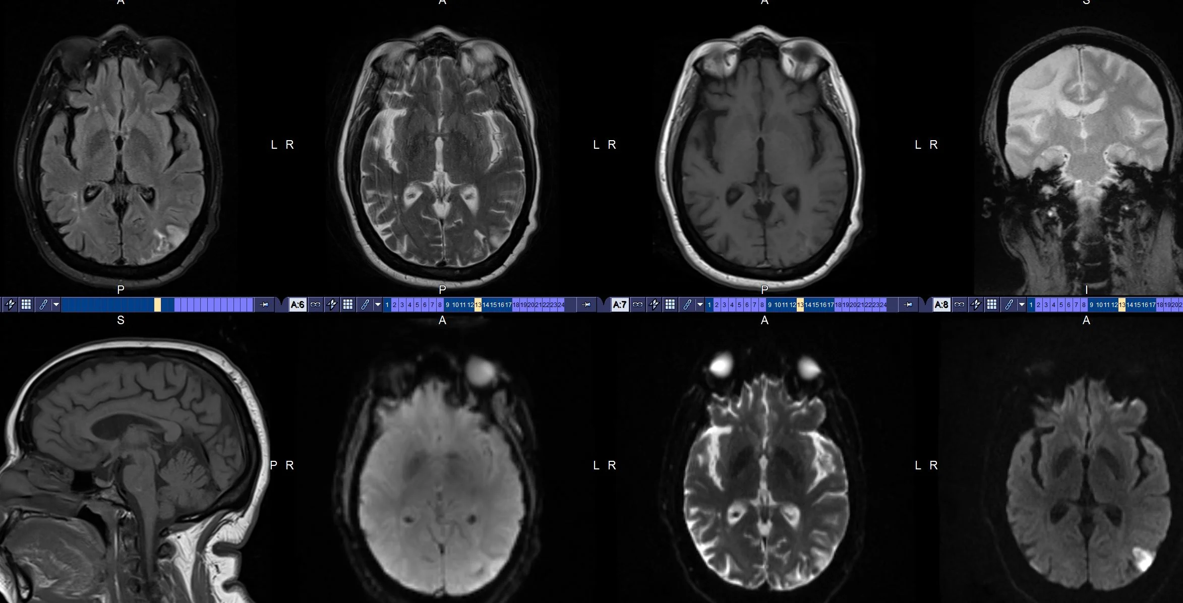 Neurological Imaging