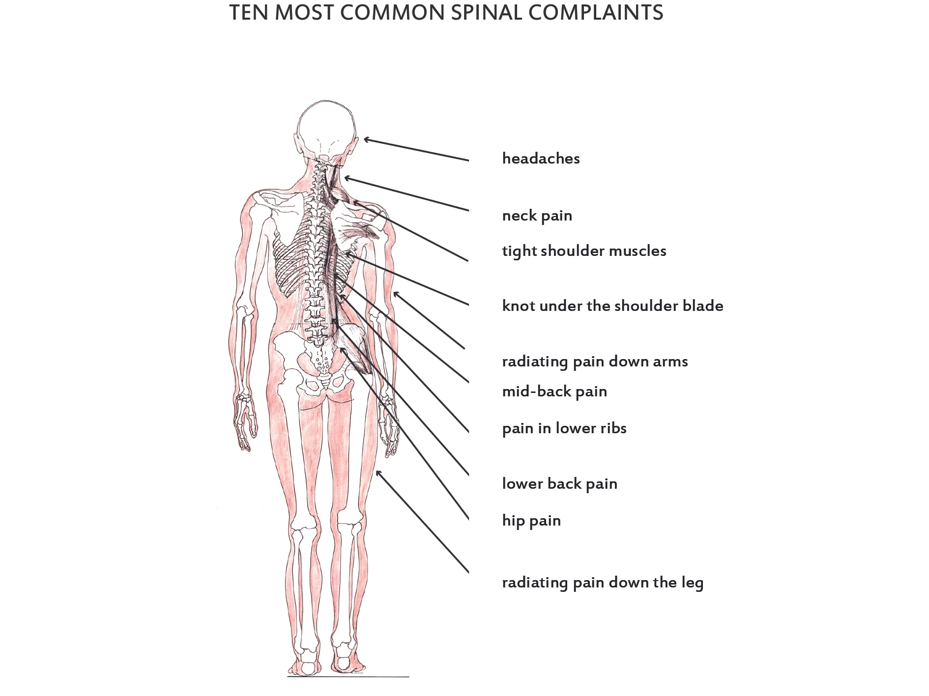 A misaligned spine with the 10 most common areas of spinal complaint - Straight Spine Chiropractic Courtenay Campbell River